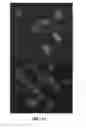 Fig. 12 - Method for the cytological analysis of cervical cells