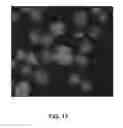 Fig. 13 - Method for the cytological analysis of cervical cells