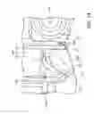 Fig. 14 - Wheel loader