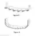 Fig. 09 - Rolled and folded lip and manufacturing method thereof