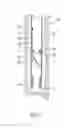 Fig. 02 - METHOD OF FORMING A BORE