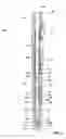 Fig. 04 - Expandable reamers and methods of using expandable reamers