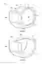 Fig. 12 - Rolling element assemblies