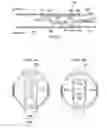 Fig. 04 - Deflector assembly for a lateral wellbore