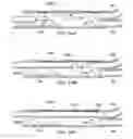 Fig. 19 - Deflector assembly for a lateral wellbore