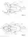 Fig. 03 - Apparatus and method to contain flange, pipe and valve leaks