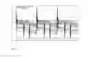 Fig. 09 - USE OF HIGHLY EFFICIENT WORKING MEDIA FOR HEAT ENGINES