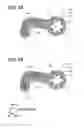 Fig. 06 - EGR device having diffuser and EGR mixer for EGR device