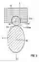 Fig. 03 - High-pressure pump