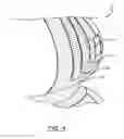 Fig. 05 - AIR SPRING BELLOWS INCLUDING RENEWABLE RESOURCES