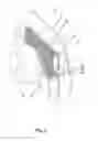 Fig. 06 - Apparatus for mounting an object to a structure in a vibration-free manner