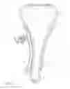 Fig. 02 - Tensioner
