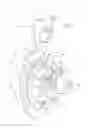 Fig. 05 - Differential gear case and method for processing same