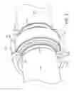 Fig. 03 - IMPROVEMENTS IN AND RELATING TO PIPE COUPLING