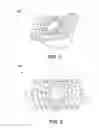 Fig. 02 - Injection-molded thick lens