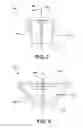 Fig. 05 - Injection-molded thick lens