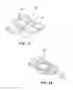 Fig. 10 - Injection-molded thick lens