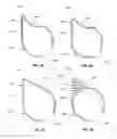 Fig. 03 - Thermal mirage reduction accessory for firearms