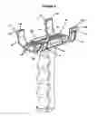 Fig. 07 - An Accessory For A Firearm