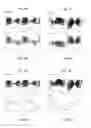 Fig. 06 - Resetting and hilbert filtering of self-mixing interferometric signal