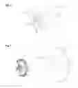 Fig. 05 - Case isolated oil filled MEMS pressure sensor