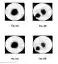 Fig. 12 - Method for imaging a medium through electrical measurements with a contact impedance correction