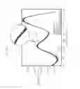 Fig. 23 - Infrared analysis of benign tumors