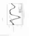 Fig. 28 - Infrared analysis of benign tumors