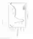 Fig. 61 - Infrared analysis of benign tumors