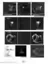Fig. 02 - Neuronal cells cultured on microparticles and methods of using same