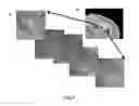 Fig. 07 - Neuronal cells cultured on microparticles and methods of using same