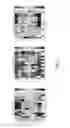 Fig. 03 - Synbodies for detection of human norovirus