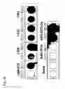 Fig. 38 - Mutated parvovirus structural proteins as vaccines