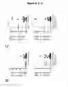 Fig. 17 - EBV PROTEINS AS MARKERS IN METHODS OF DIAGNOSING CHRONIC FATIGUE SYNDROME (CFS)