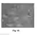 Fig. 11 - Drug target capturing method