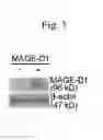 Fig. 04 - Method for determining depression, kit for analyzing serotonin transporter, and kit for analyzing ubiquitinated serotonin transporter in blood