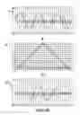 Fig. 04 - Electrical signal measurement