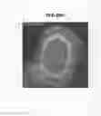 Fig. 14 - Magnetic resonance imaging apparatus
