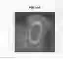 Fig. 17 - Magnetic resonance imaging apparatus