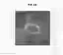 Fig. 22 - Magnetic resonance imaging apparatus
