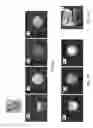 Fig. 13 - MSC-SELMQC method for simultaneous mapping of polyunsaturated fatty acids, lactate and choline in high fat tissues