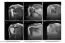 Fig. 01 - Magnetic resonance imaging method canceling artifacts and undesired signals