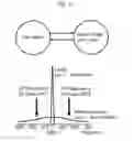 Fig. 06 - Magnetic resonance imaging method canceling artifacts and undesired signals