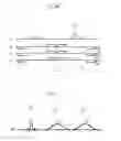 Fig. 10 - Magnetic resonance imaging method canceling artifacts and undesired signals