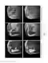 Fig. 12 - Magnetic resonance imaging method canceling artifacts and undesired signals