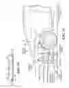 Fig. 10 - Speed Bump Bomb Detector for Bombs in Vehicles