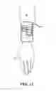 Fig. 11 - Speed Bump Bomb Detector for Bombs in Vehicles