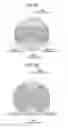 Fig. 08 - Lens device and image capturing device for acquiring distance information at high accuracy