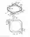 Fig. 05 - Ball-bearing retainers