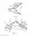 Fig. 06 - Ball-bearing retainers